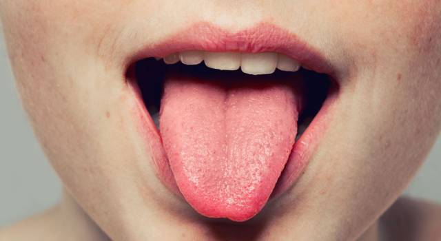 Come disinfettare piercing sulla lingua