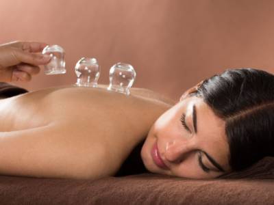 Donna Cupping Therapy