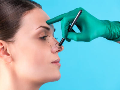 Rinofiller: il trattamento al naso alternativo alla rinoplastica