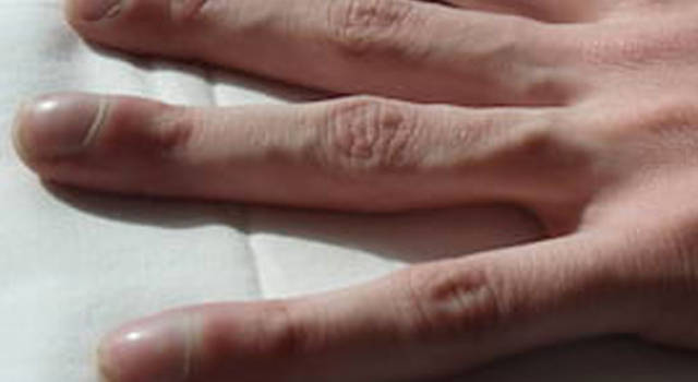 Le unghie sono in grado di dirci tutto sulla nostra salute