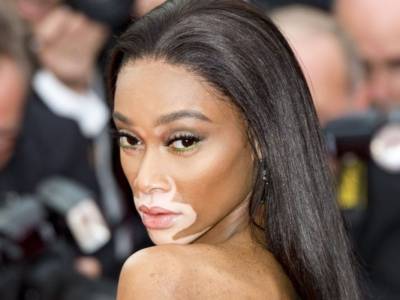 Winnie Harlow