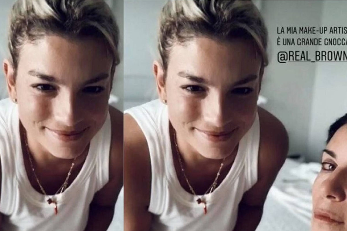 Emma Marrone: la prima foto dopo l’operazione non è quello che sembra…