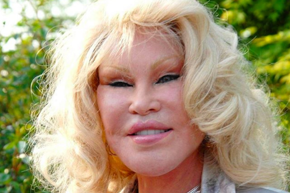 Jocelyn Wildenstein