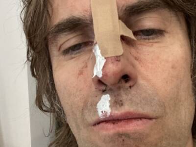 Liam Gallagher