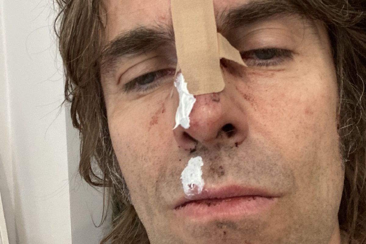 Liam Gallagher