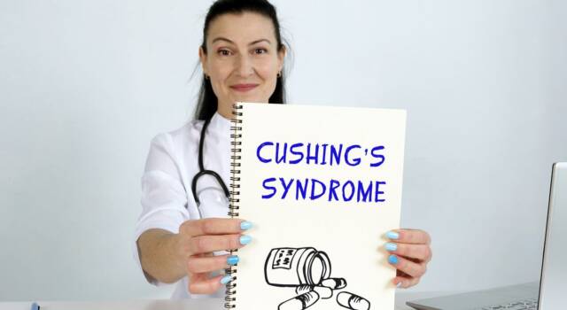 Sindrome di Cushing: sintomi e cura della malattia di cui soffrirebbe Putin