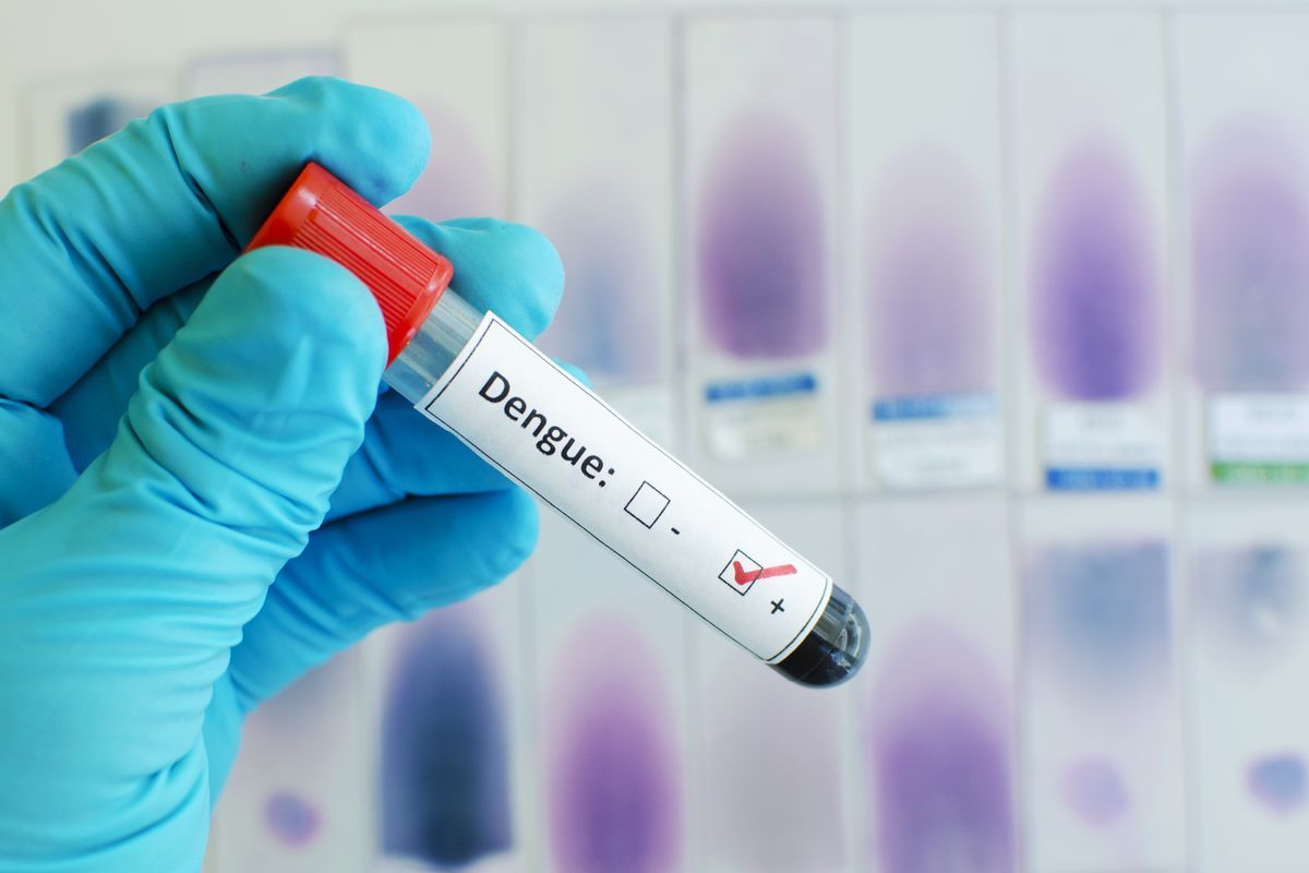 test sangue virus dengue