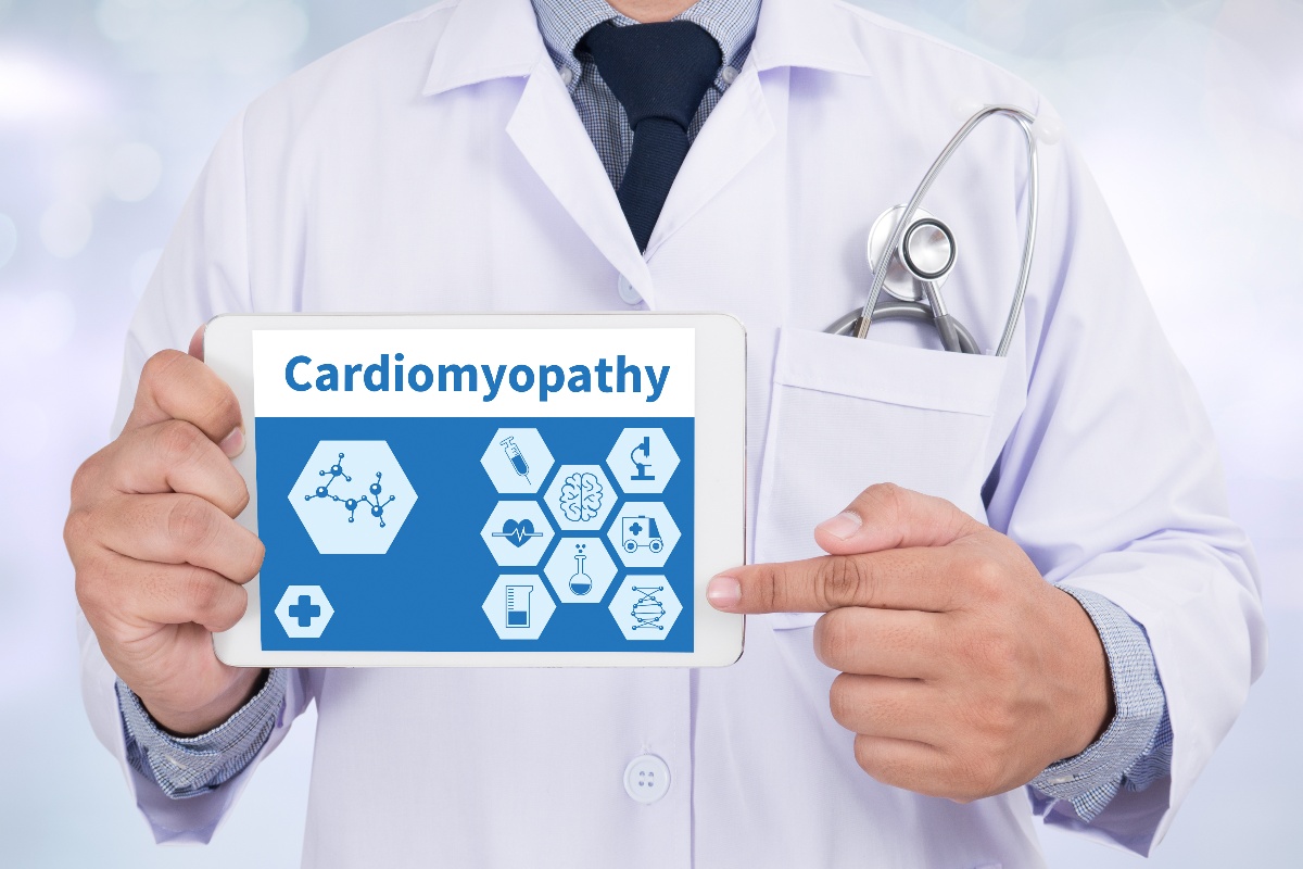 Cos’è la cardiomiopatia ipertrofica? Cause, sintomi e cura